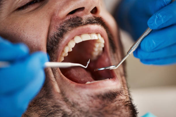 Best After-Hours Emergency Dentist in Marshall, MO